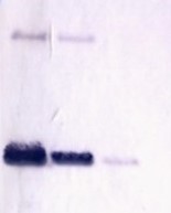 Zip7 | Zinc transporter protein Zip7 in the group Antibodies for Plant/Algal / Developmental Biology / Ion metabolism at Agrisera AB (Antibodies for research) (AS08 318)